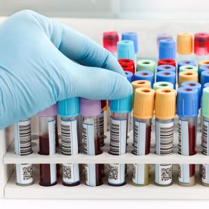 Tuburi de sânge Vacutainer